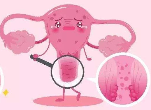 白带常规香蕉视频成年人厂家提醒女士做好私密处清洗