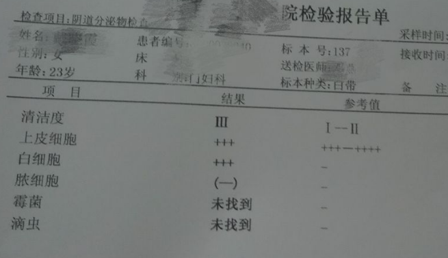 白带香蕉视频成年人厂家教您看懂白带检验单