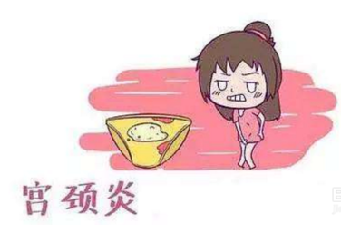 妇科白带香蕉视频下载安装厂家分析宫颈炎的症状