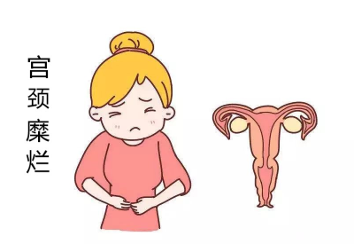 宫颈糜烂会导致宫颈癌?白带香蕉视频成年人品牌：不要自己吓自己