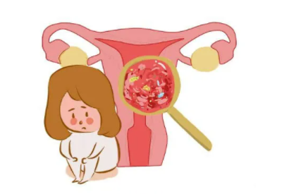阴道分泌物香蕉视频下载安装厂家总结病理性的白带异常有哪些