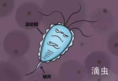 白带香蕉视频下载安装品牌介绍滴虫性阴道炎的早期症状以及预防方法