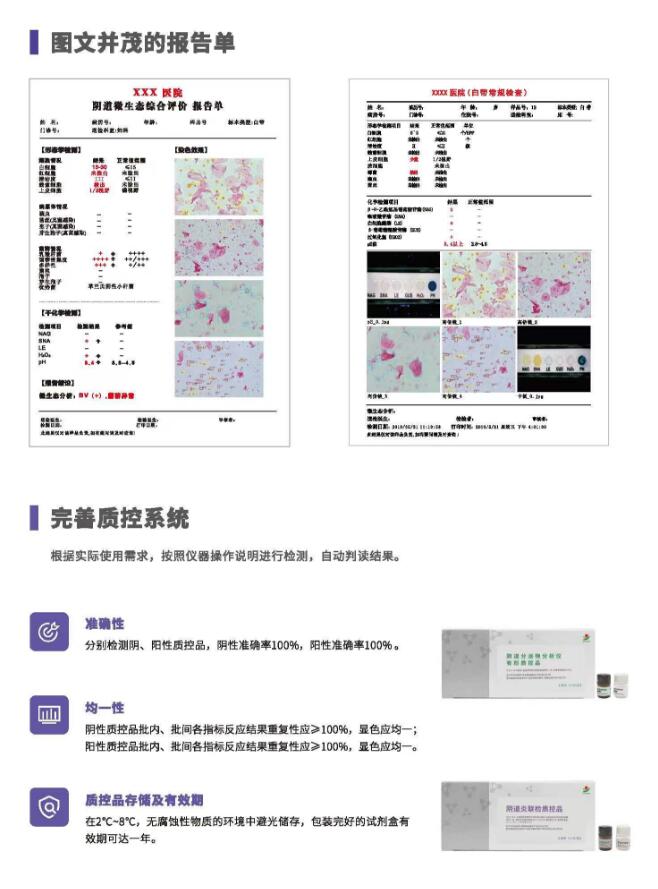 阴道分泌物香蕉视频成年人V800报告单