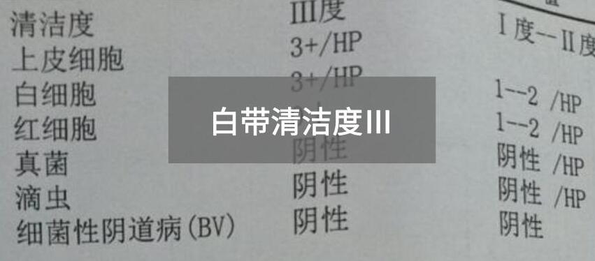 今天快讯！全自动白带香蕉视频成年人生产厂家91香蕉下载安装为您官方解释白带清洁度3的意思