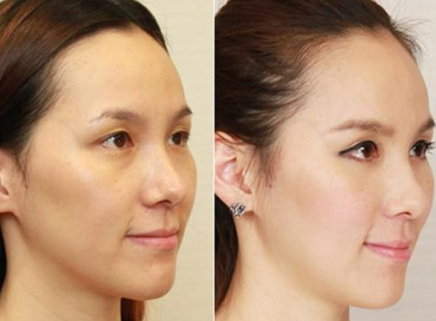 【全自动白带香蕉视频下载安装品牌91香蕉下载安装】提示女性开端变老的身体警告